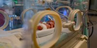 wired premature baby lies in the incubator